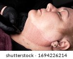 Fibroblast, plasmalifting procedure womens neck wrinkles lifting