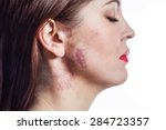 Small photo of Beautiful woman with real port-wine stain (birthmark) on her face, isolated on white background. converted from raw and edited with special care.