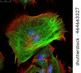 Small photo of Real fluorescence microscopic view of human skin cells in culture. Nucleus are in blue, actin filaments are in green, tubulin was labeled with red