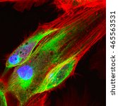 Small photo of Real fluorescence microscopic view of human skin cells in culture. Nucleus are in blue, actin filaments are in red, tubulin was labeled with green