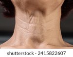 Neck  wrinkles and lines of...