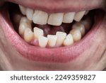 European male open mouth crooked teeth lips front view
