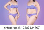 Small photo of Tummy tuck, cellulite removal, woman's body before and after weight loss on purple studio background, plastic surgery concept