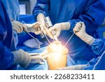 Small photo of Team of orthopedic doctor in blue sterile uniform doing total knee joint arthroplasty.Knee replacement surgery is done by surgeon inside operating room in hospital.Selective focus with light effect.