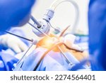 Surgeon or doctor did laparoscopy or endoscopy on minimal invasive surgery inside operating room in hospital.Surgeon in blue uniform did arthroscopic joint surgery with medical equipment or technology