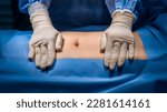 Small photo of Abdomen prepare for abdominal surgery with sterile drape.Surgeon or nurse in blue uniform put hands with glove on patient.Abdominal surgery inside operating room in hospital.Hernia repair surgery.