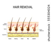 hair removal with wax  cream ... | Shutterstock .eps vector #555304024