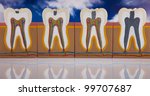anatomy of the tooth | Shutterstock . vector #99707687
