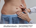 Small photo of the doctor makes markings with a marker before the tummy tuck operation, Abdominoplasty